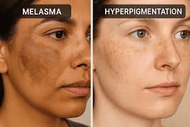 Spermidine: A substance found in human sperm helps Reducing Wrinkles, Tightening Skin,  Addressing Melasma and reduce hair Fall